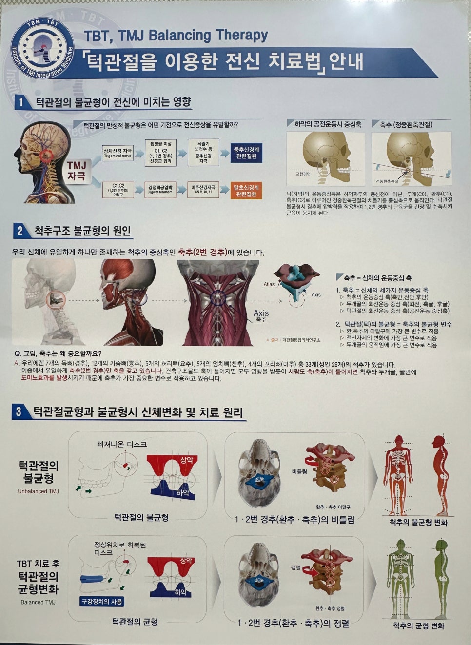턱관절 불균형이 전신에 미치는 영향과 치료법을 설명하는 포스터로, 턱관절의 불균형 원인, 척추 구조 불균형의 원인, 치료 원리 등을 도표와 그림으로 설명하고 있다.